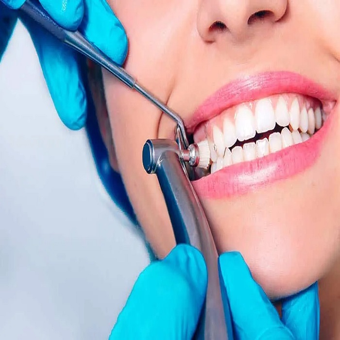 teeth cleaning in East Gwillimbury | Sharon Dental